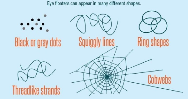 Eye Floaters