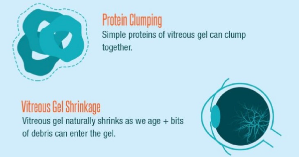 Protein CLlumping and Vitreous Gel Shrinkage