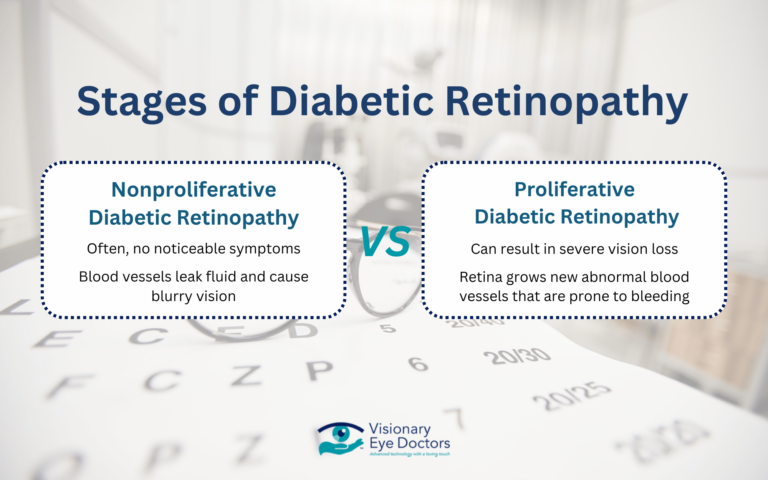 Picture of Can Diabetic Retinopathy Be Reversed? What You Need to Know