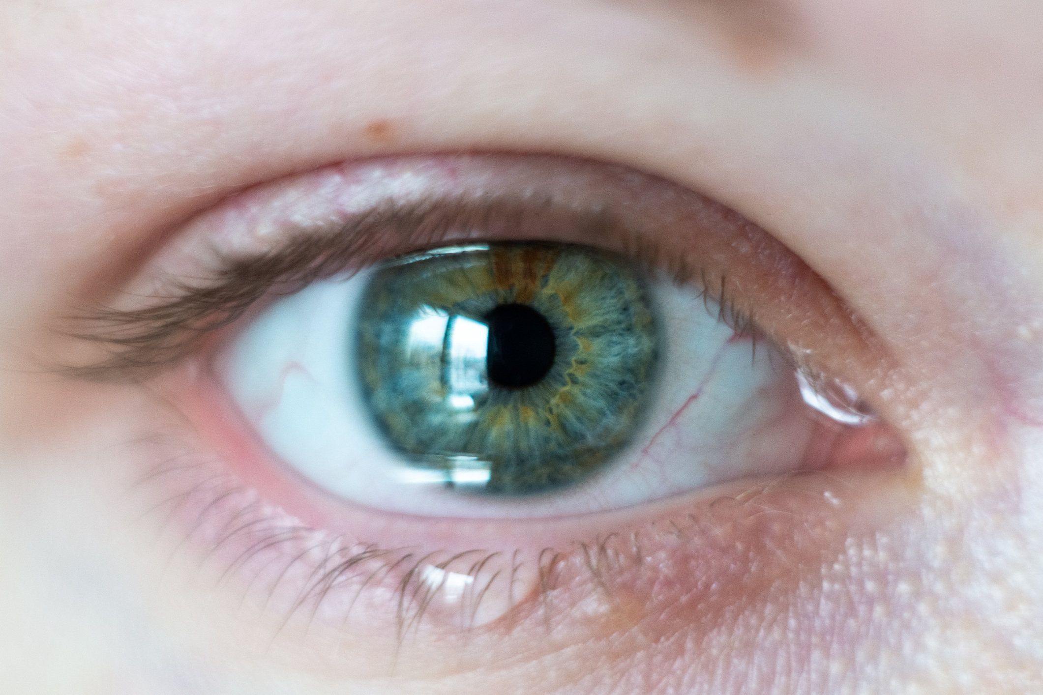Image of a green eye producing tears.