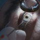 Close up of a patient receiving cataract surgery.