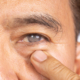 Senior man has cataract. Generally, cataracts are common in older people.